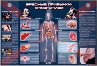 Электрифицированный стенд "Вредные привычки: алкоголизм" - fgospostavki.ru - Ивантеевка