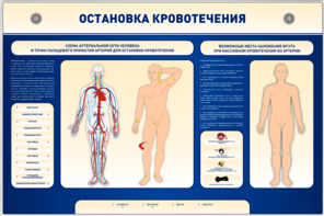 Электрифицированный стенд-тренажер "Остановка кровотечения" - fgospostavki.ru - Ивантеевка